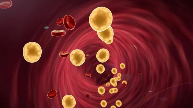 bai-viet/roi-loan-chuyen-hoa-lipid-trong-mau-la-nhu-the-nao-nguyen-nhan-va-dieu-tri.html