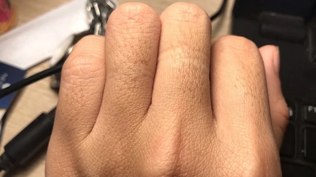 bai-viet/co-nen-cao-long-ngon-tay-khong-63791.html