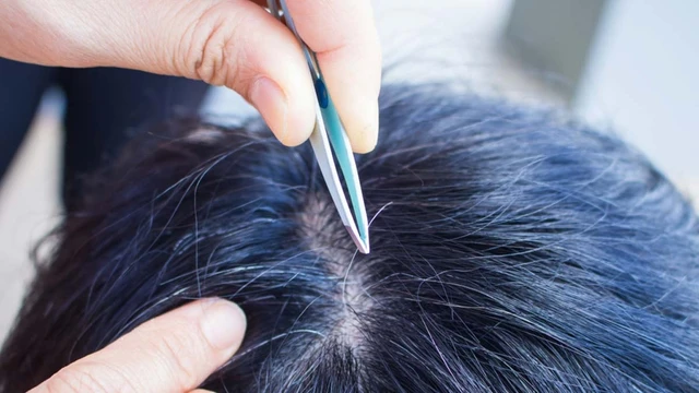 bai-viet/co-nen-nho-toc-bac-khong-nhung-su-that-ban-can-biet.html