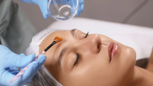 bai-viet/co-nen-peel-da-mat-khong-uu-diem-va-han-che-cua-peel-da-mat.html