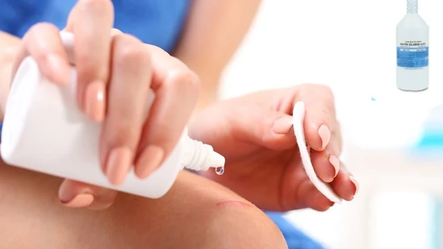 bai-viet/co-nen-rua-vet-thuong-bang-nuoc-muoi-sinh-ly-58540.html