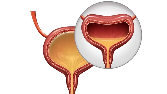 bai-viet/co-that-bang-quang-la-gi-dieu-tri-co-that-bang-quang-hieu-qua.html