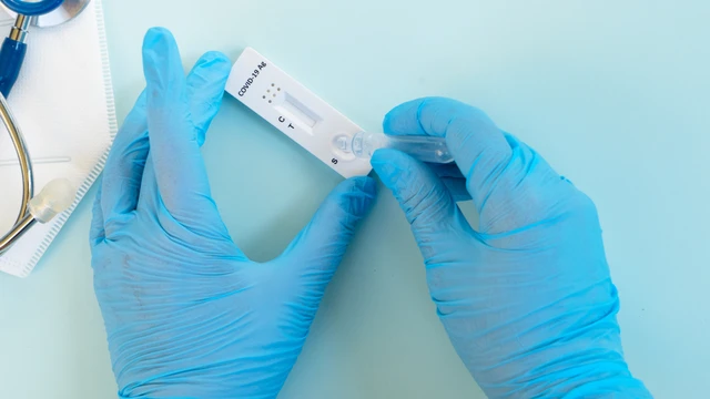 Có triệu chứng nào thì cần test nhanh Covid-19? 0