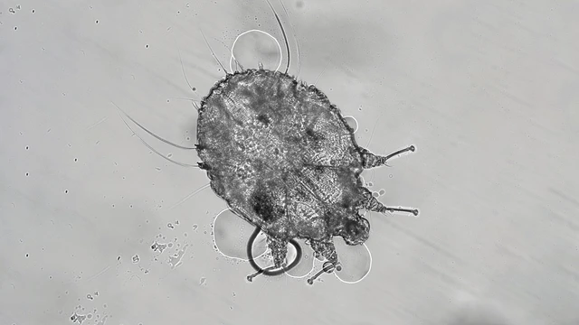 bai-viet/con-cai-ghe-la-gi-co-nguy-hai-den-suc-khoe-khong.html