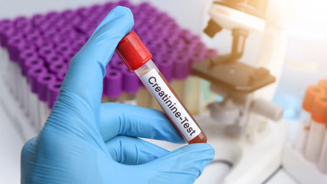 bai-viet/cong-thuc-tinh-do-thanh-thai-creatinin-y-nghia-cach-tinh-va-ung-dung-trong-y-khoa.html