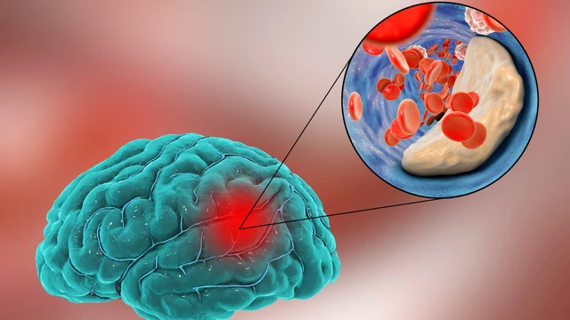 bai-viet/cuc-mau-dong-trong-nao-duoc-hinh-thanh-do-dau.html