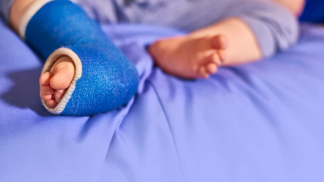 benh/cung-da-khop-bam-sinh.html