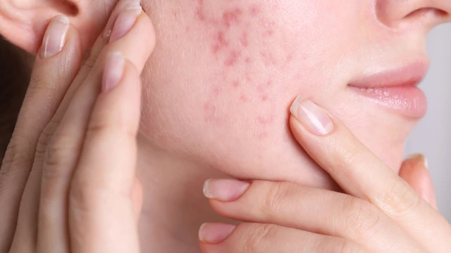 bai-viet/da-dau-can-bo-sung-vitamin-gi-de-cai-thien-luong-ba-nhon-hieu-qua.html