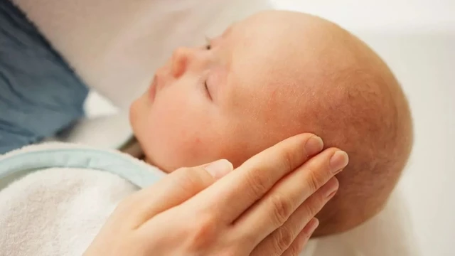 bai-viet/da-dau-tre-so-sinh-bi-do-nguyen-nhan-do-dau-lam-the-nao-de-tri.html