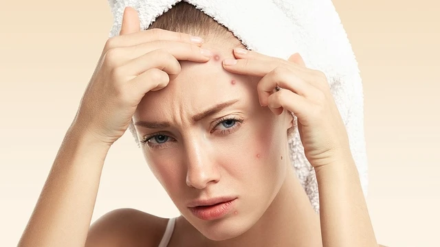 bai-viet/da-mat-dot-nhien-noi-nhieu-mun-do-dau.html