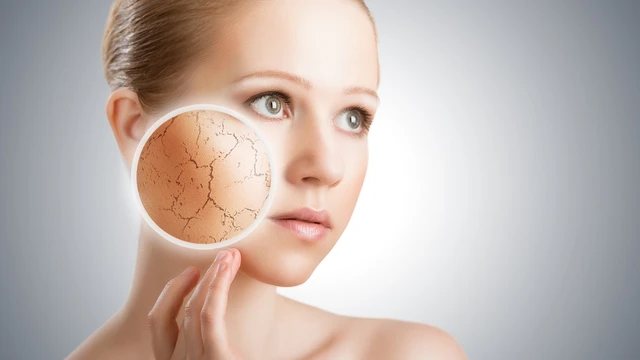 bai-viet/da-mat-kho-nut-ne-vao-mua-dong-do-rat-bong-troc-nen-lam-gi-61225.html