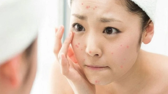 bai-viet/da-mun-co-nen-dap-sua-chua-khong-duong.html