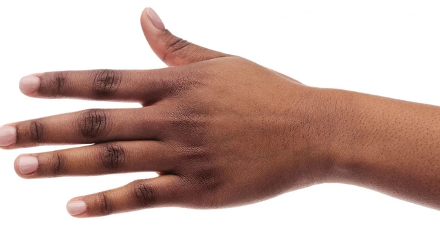 bai-viet/da-ngon-tay-bi-tham-den-nguyen-nhan-la-do-dau.html