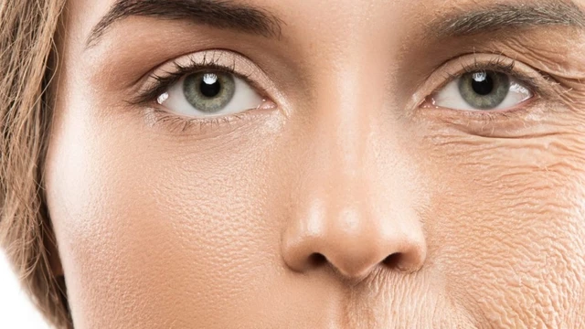 bai-viet/da-nhan-nheo-cai-thien-5-thoi-quen-xau-giup-ban-lay-lai-lan-da-tre-trung.html