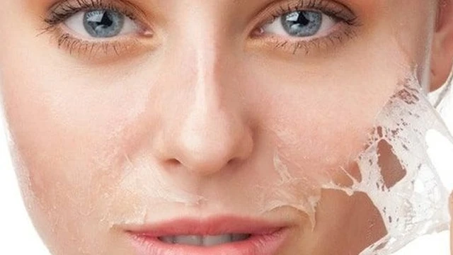 bai-viet/da-nhay-cam-co-nen-peel-da-khong-bi-quyet-cham-soc-cho-lan-da-nhay-cam.html