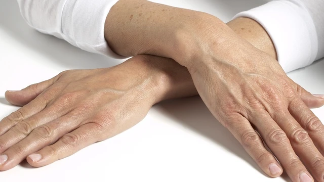 bai-viet/da-tay-bi-lao-hoa-som-phai-lam-sao-50980.html