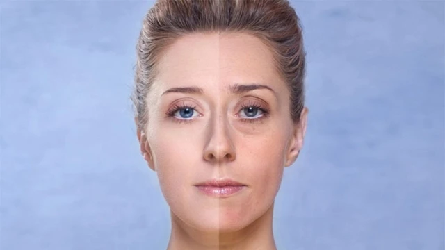 bai-viet/da-xin-mau-sam-den-la-do-dau-cach-khac-phuc-da-xin-mau-hieu-qua.html