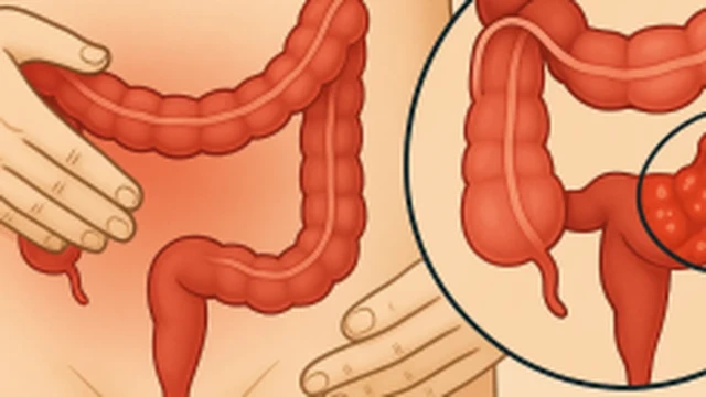 bai-viet/dai-trang-chau-hong-la-gi-cac-benh-ly-lien-quan-den-dai-trang-chau-hong.html