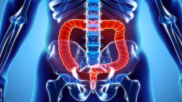 bai-viet/dai-truc-trang-la-gi-cac-benh-ly-thuong-gap-o-dai-truc-trang.html