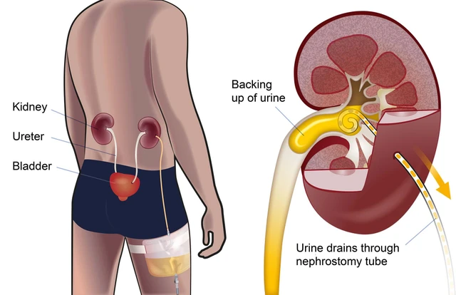 bai-viet/dan-luu-be-than-qua-da-la-phuong-phap-gi.html
