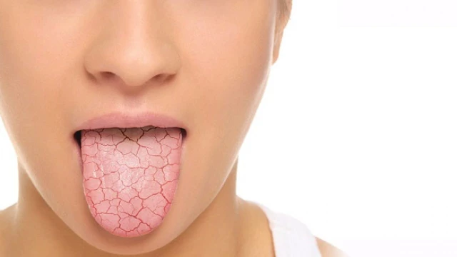 bai-viet/dang-mieng-khi-ngu-day-la-benh-gi-57634.html