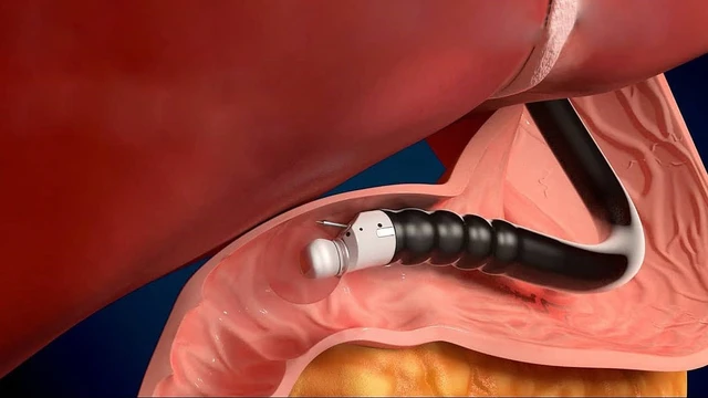 bai-viet/dau-da-day-nen-sieu-am-hay-noi-soi-cho-ket-qua-tot-nhat.html