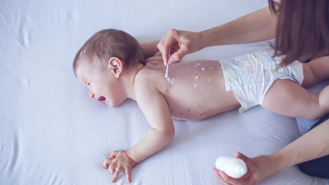 bai-viet/dau-hieu-canh-bao-benh-thuy-dau-nang-nhung-bien-chung-khon-luong-cua-benh.html