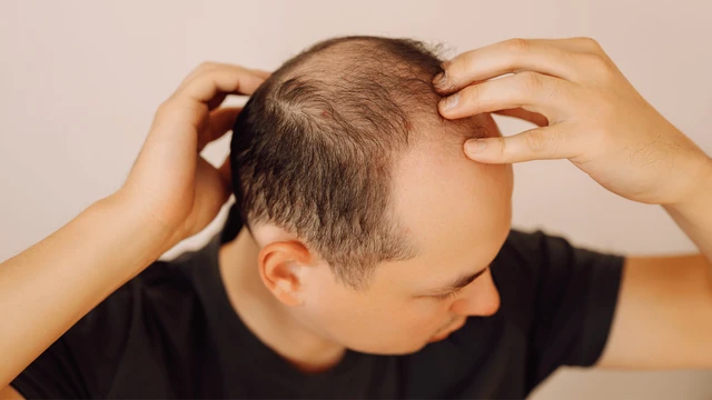 bai-viet/dau-hieu-nam-da-dau-la-gi-nguyen-nhan-cua-benh-nam-da-dau.html