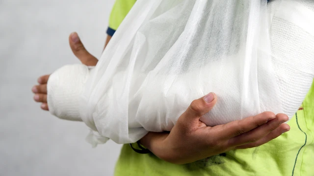 bai-viet/dau-hieu-nhan-biet-dieu-tri-va-thoi-gian-hoi-phuc-chan-thuong-gay-2-xuong-cang-tay.html