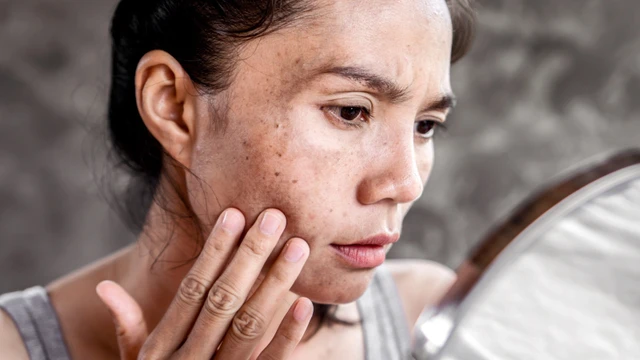 bai-viet/dau-hieu-nhan-biet-da-thieu-nuoc-va-cach-cai-thien.html