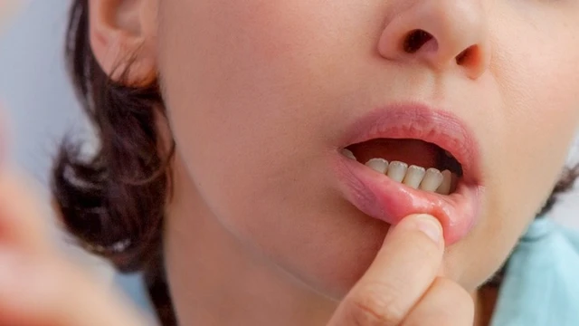 bai-viet/dau-hieu-nhan-biet-noi-den-o-nuou-rang.html