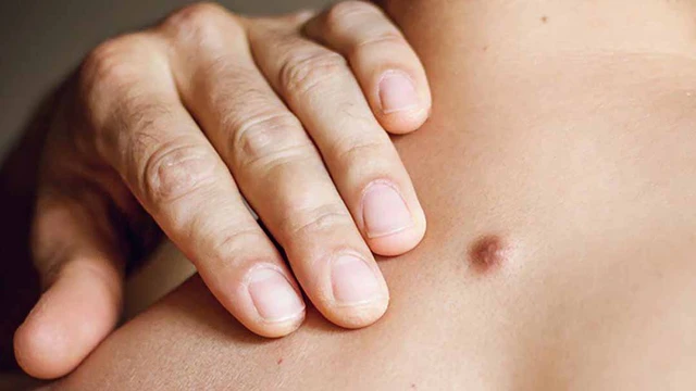 bai-viet/dau-hieu-nhan-biet-u-ba-dau-dieu-tri-u-ba-dau-nhu-the-nao.html