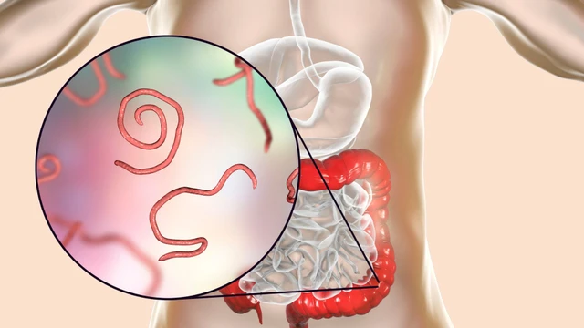 bai-viet/dau-hieu-nhiem-giun-kim-o-tre-em-khi-tre-bi-nhiem-giun-kim-phai-lam-sao.html