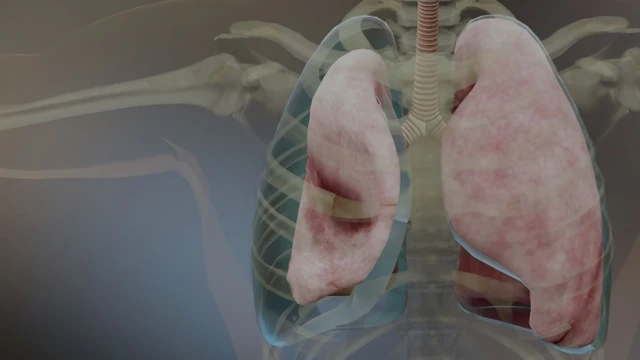 bai-viet/tong-hop-cac-dau-hieu-tran-dich-mang-phoi-ban-khong-nen-bo-qua.html