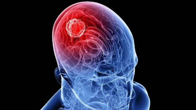 bai-viet/dau-hieu-u-nguyen-bao-than-kinh-o-tre-em-la-gi-63438.html