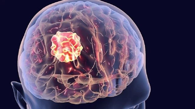 bai-viet/dau-hieu-ung-thu-nao-giai-doan-dau-ma-ban-can-canh-giac.html