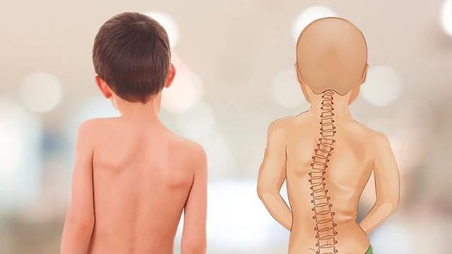 bai-viet/dau-hieu-veo-cot-song-va-cach-tu-kiem-tra-veo-cot-song.html