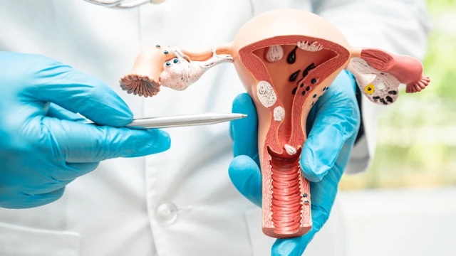 bai-viet/dau-hieu-viem-co-tu-cung-la-gi-nguyen-nhan-dieu-tri-va-cach-phong-tranh-viem-co-tu-cung.html