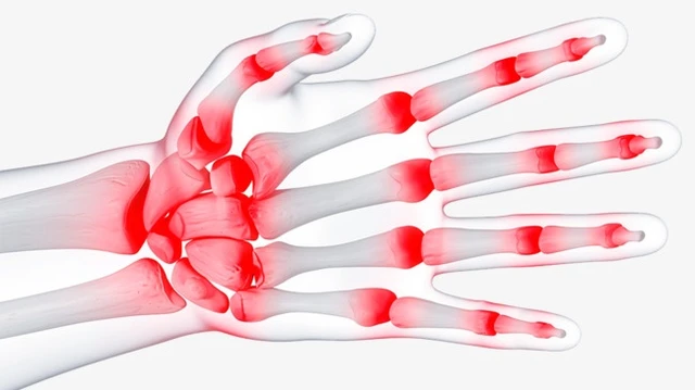 bai-viet/dau-khop-ngon-tay-deo-nhan-la-benh-gi-co-cach-khac-phuc-khong-61423.html