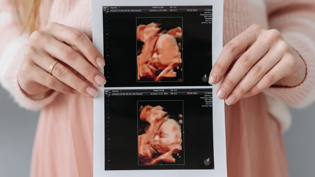 bai-viet/di-tat-thai-nhi-la-gi-phan-loai-va-cac-di-tat-bam-sinh-thuong-gap.html