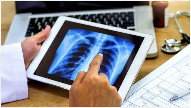 bai-viet/di-tat-xuong-uc-ga-la-gi-nguyen-nhan-trieu-chung-va-phuong-phap-dieu-tri.html