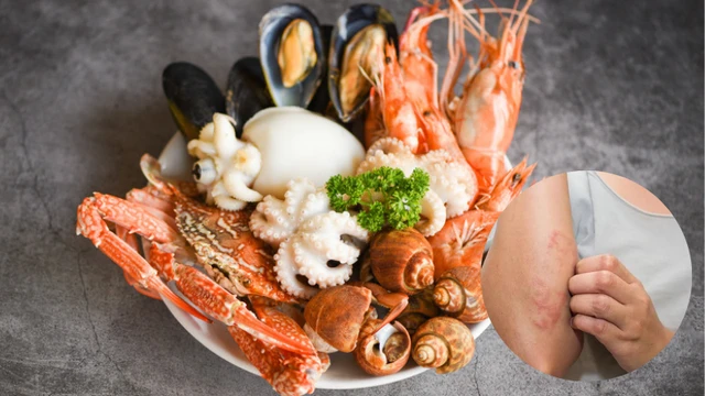 bai-viet/di-ung-dong-vat-co-vo-trieu-chung-nguyen-nhan-va-cach-xu-tri.html