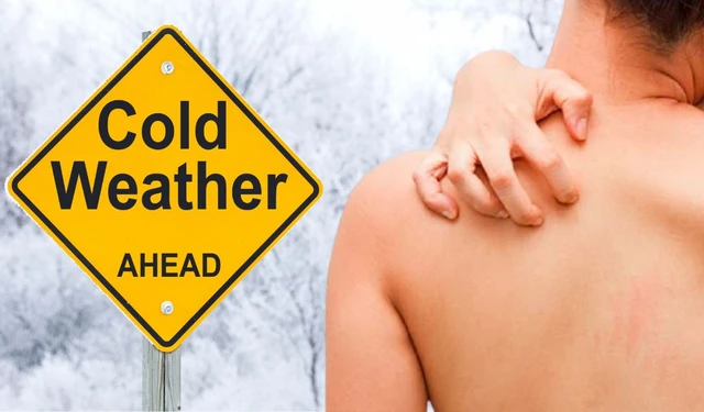 bai-viet/di-ung-gio-lanh-la-nhu-the-nao-lam-gi-de-khac-phuc-trieu-chung-60744.html