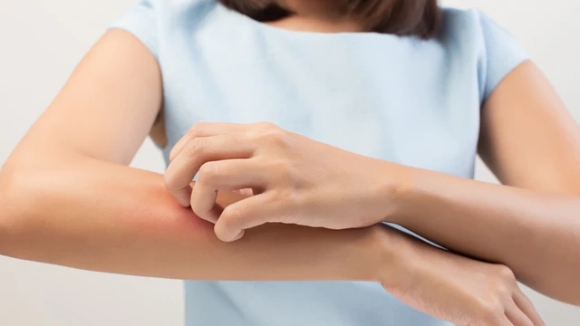 bai-viet/di-ung-la-gi-cac-kieu-di-ung-pho-bien-59849.html