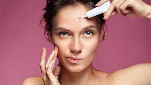 bai-viet/diem-danh-10-loai-thuoc-tri-mun-trung-ca-cho-da-nhon-ma-ban-nen-biet.html