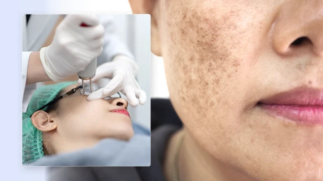 bai-viet/diem-danh-cac-cong-nghe-dieu-tri-nam-moi-nhat.html