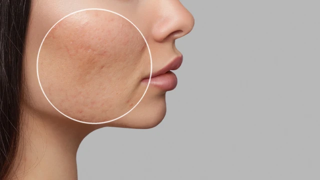 bai-viet/diem-khac-biet-giua-seo-day-nhon-va-lo-chan-long-to.html