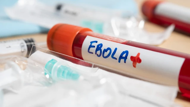 bai-viet/dien-bien-hien-tai-cua-dich-ebola-tai-chau-phi.html