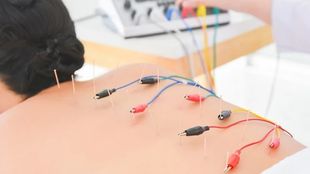 bai-viet/dien-cham-chua-dau-vai-gay-co-hieu-qua-khong-cac-buoc-tien-hanh-ky-thuat-dien-cham.html