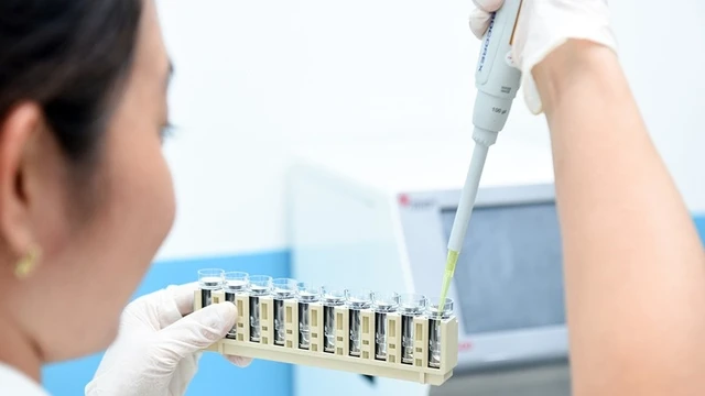 bai-viet/dien-giai-do-la-gi-vi-sao-can-phai-xet-nghiem-dien-giai-do.html